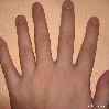 рука с шестью пальцами